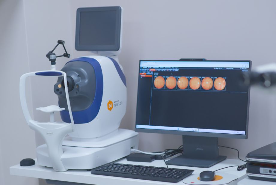 Non-Mydriatic-Retinal-Camera